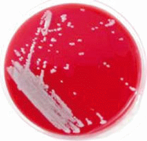 Culture of Ewingella americana on blood agar